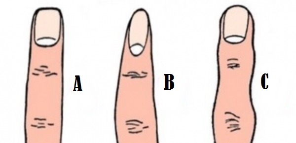 Forma degetelor
