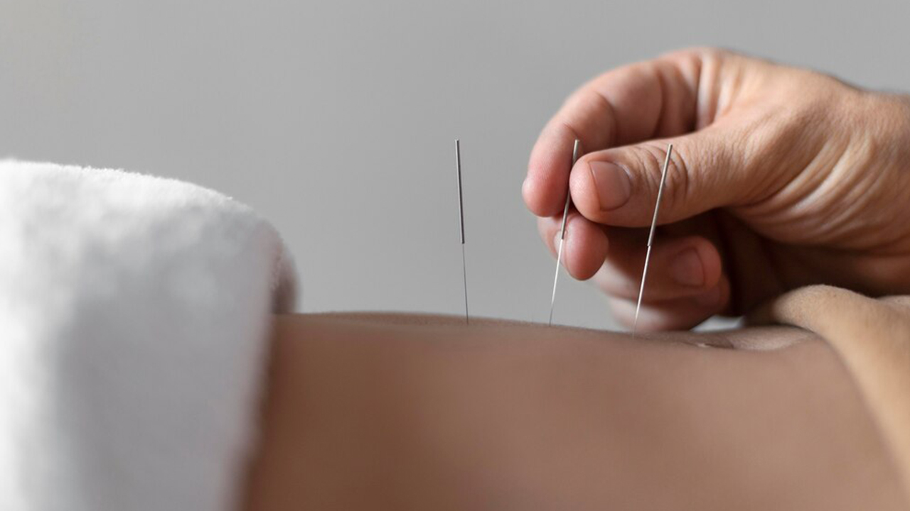 Acupunctura: 10 fapte fascinante care dezvăluie minunile acestei arte